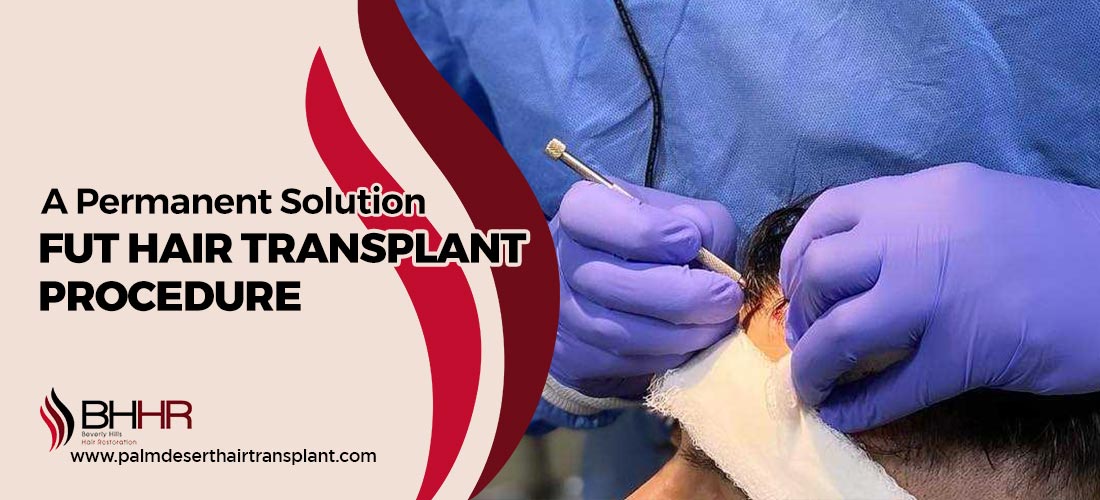 Fut Hair Transplant Procedure