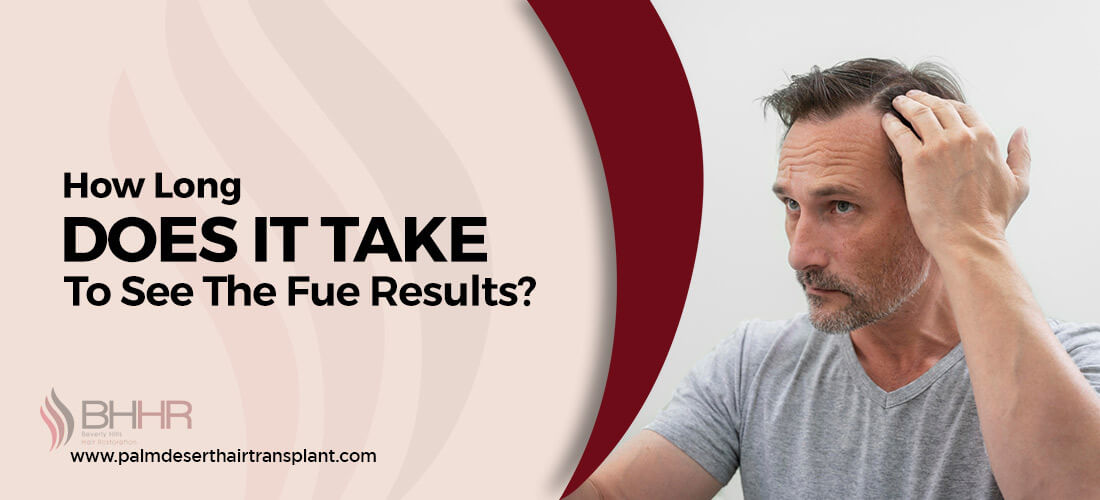 hair transplant fue results