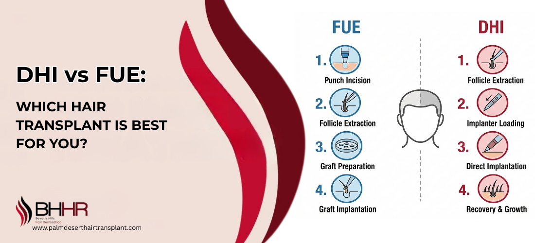dhi vs fue hair transplant