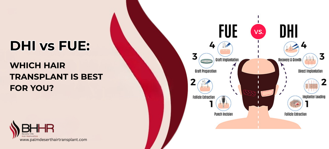 dhi vs fue hair transplant