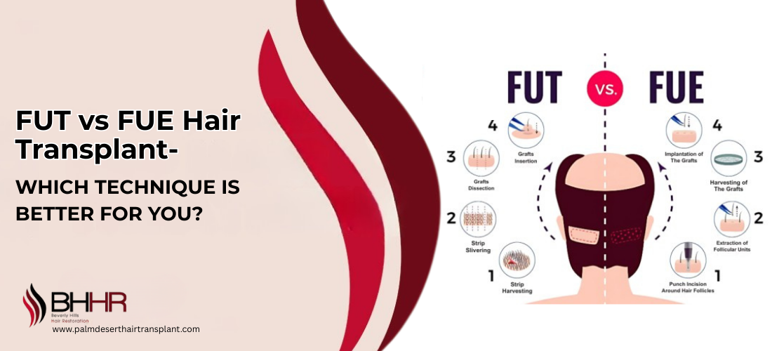 FUE vs FUT hair transplan