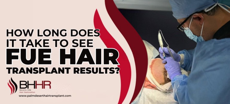 FUE Hair Transplant Results