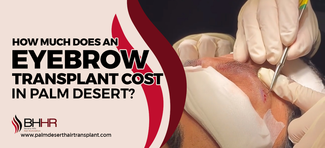 Eyebrow transplant cost