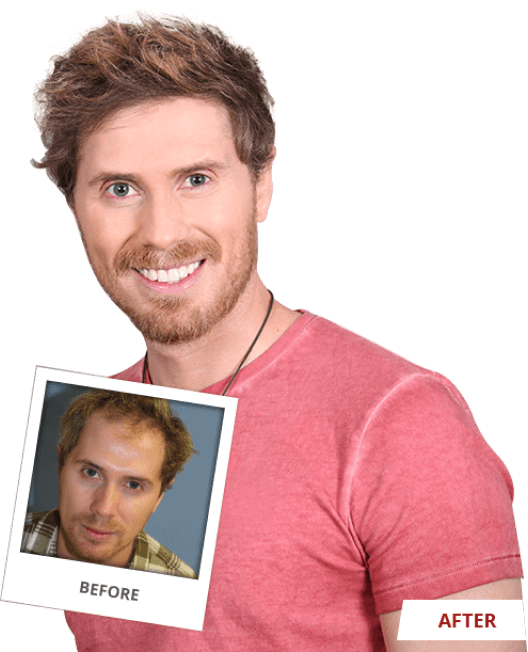 Patient Before and After Image