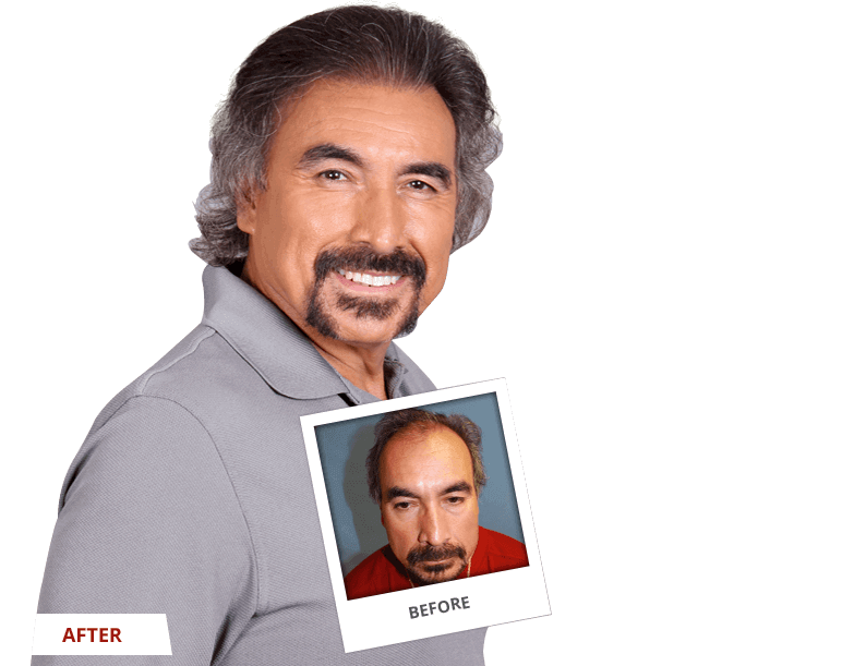 award-winning-transformations